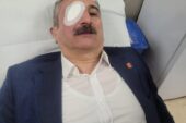 CHP İl Başkanı Nihat Yeşiltaş Yaralandı