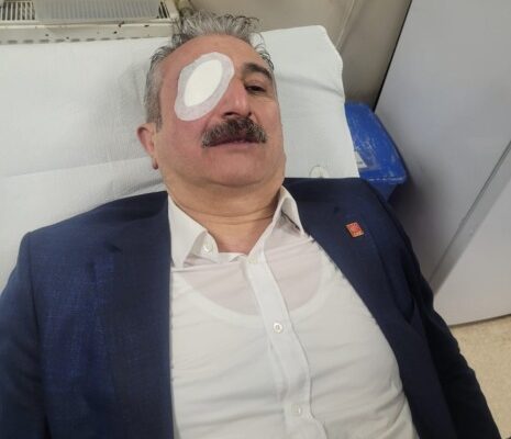CHP İl Başkanı Nihat Yeşiltaş Yaralandı